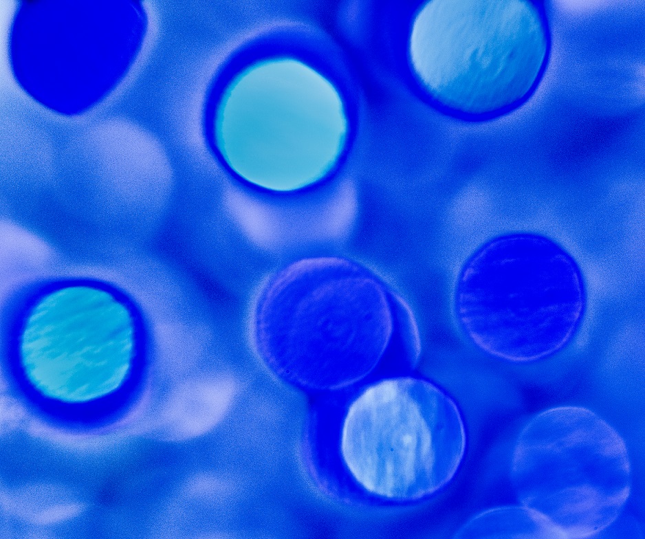 TreshaBarger-Blue-2018-wk25